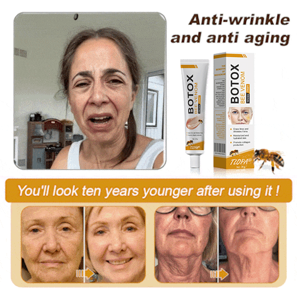 (Made and Shipped from USA) 🧑⚕️TLOPA® Botox Bee Venom Wrinkle Removal Cream- LAST DAY 70% OFF🔥