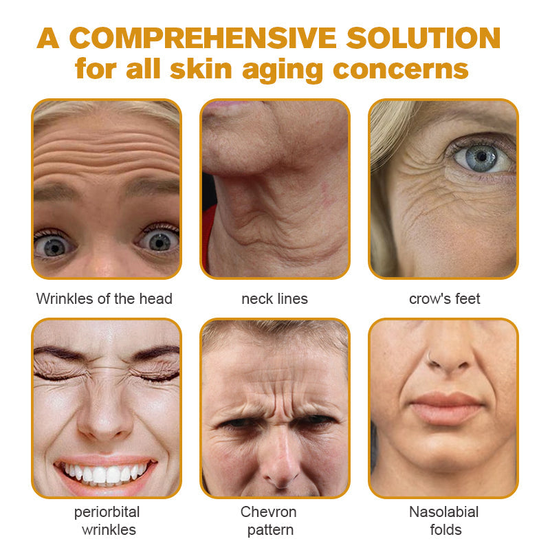 (Made and Shipped from USA) 🧑⚕️TLOPA® Botox Bee Venom Wrinkle Removal Cream- LAST DAY 70% OFF🔥