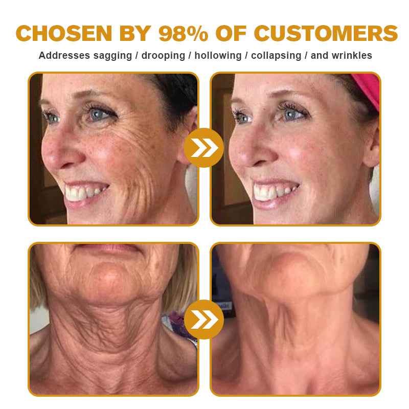 (Made and Shipped from USA) 🧑⚕️TLOPA® Botox Bee Venom Wrinkle Removal Cream- LAST DAY 70% OFF🔥