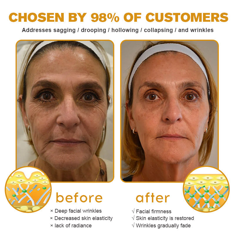 (Made and Shipped from USA) 🧑⚕️TLOPA® Botox Bee Venom Wrinkle Removal Cream- LAST DAY 70% OFF🔥