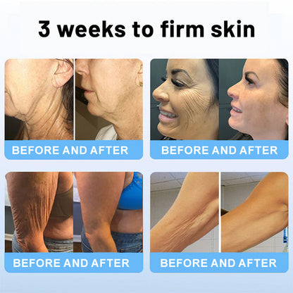 🌸TLOPA® Botox Bee Venom Firming Serum Stick(🔥LAST DAY 70% OFF)🧡