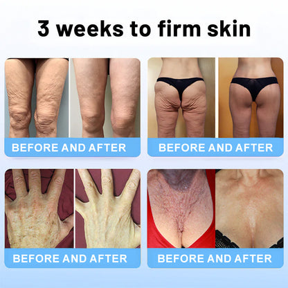 🌸TLOPA® Botox Bee Venom Firming Serum Stick(🔥LAST DAY 70% OFF)🧡